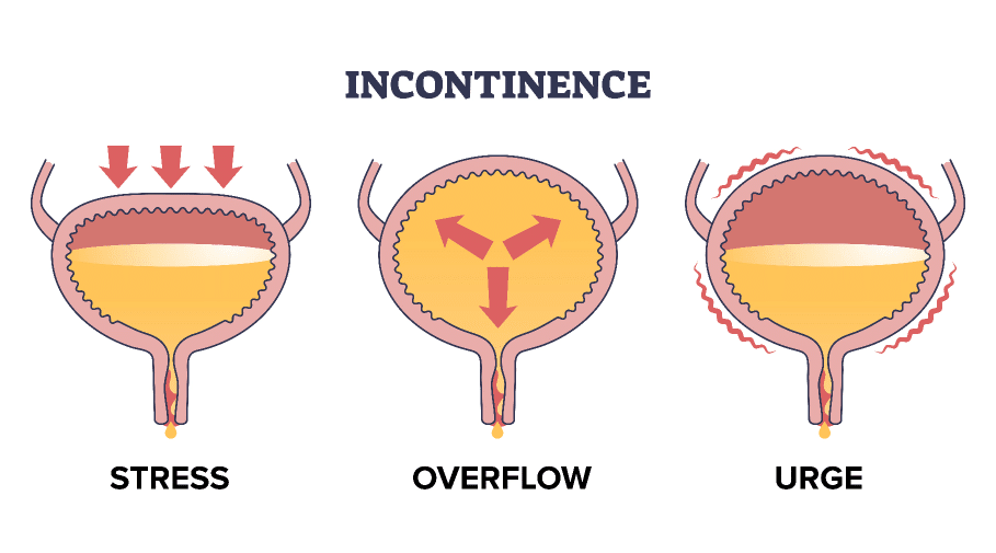 incontinence