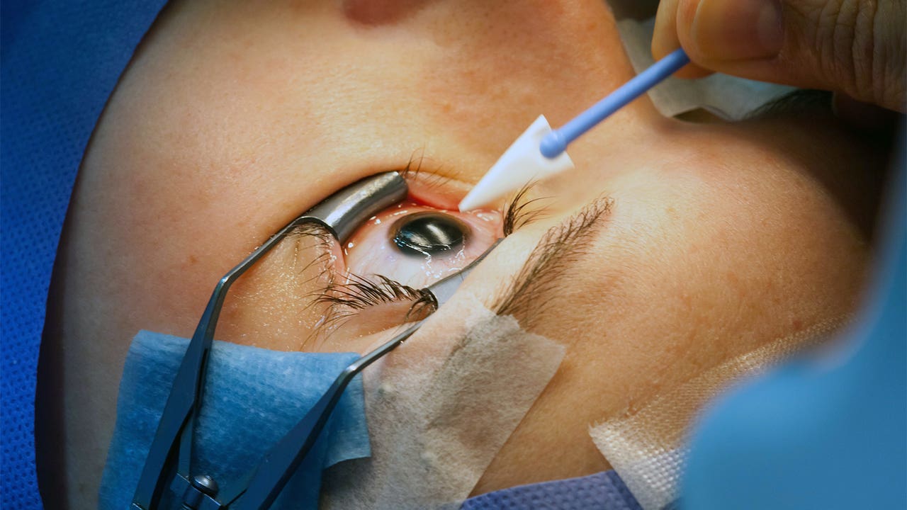 Eye Surgery