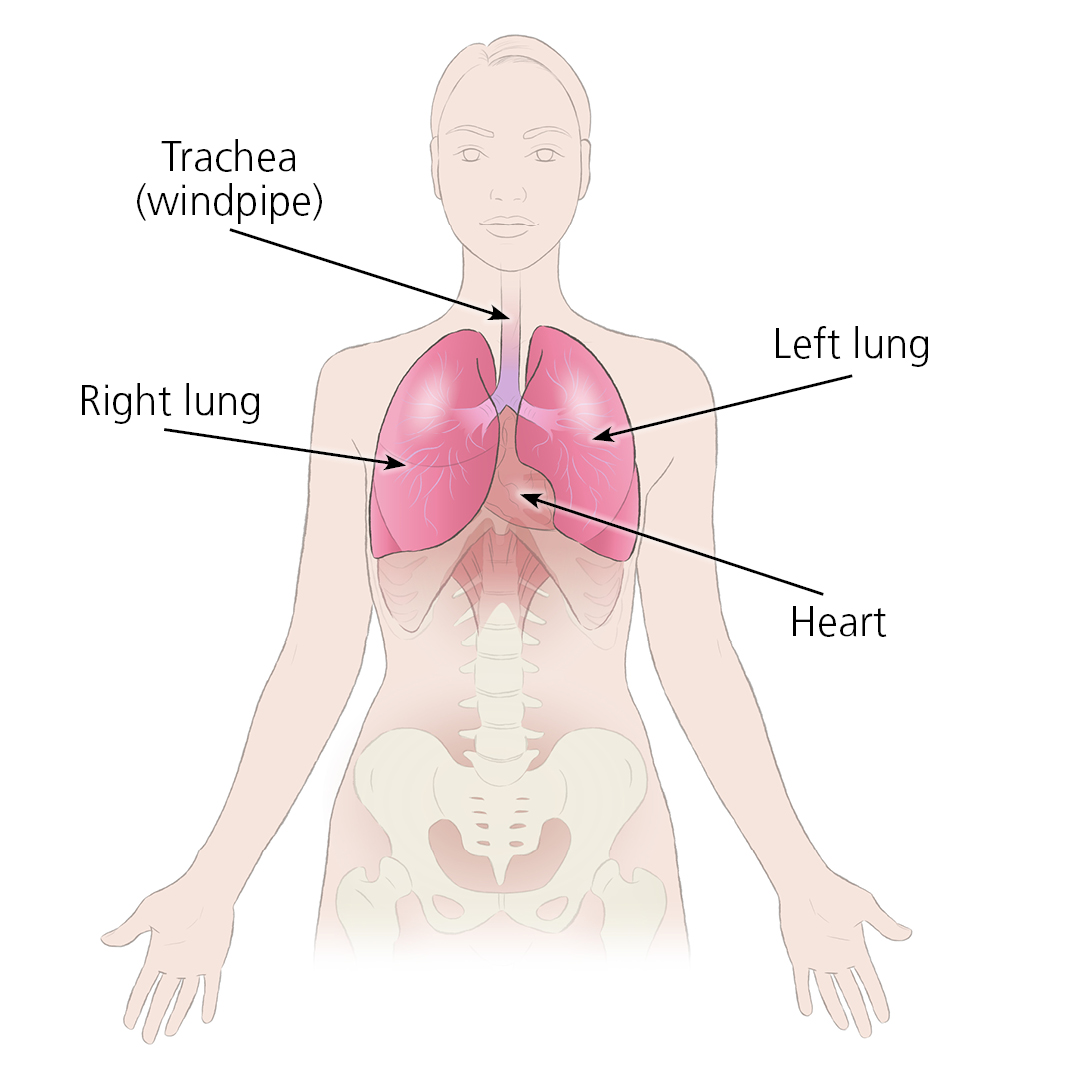 Lung Transplant