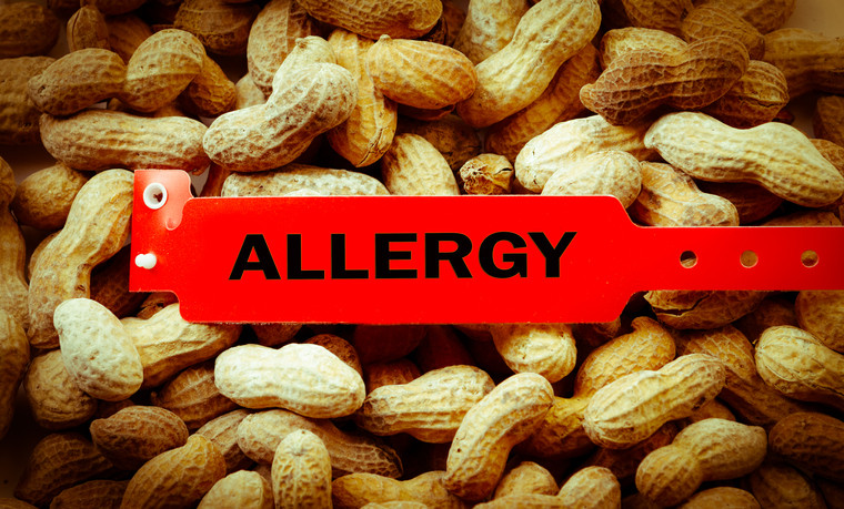 Peanut Allergy