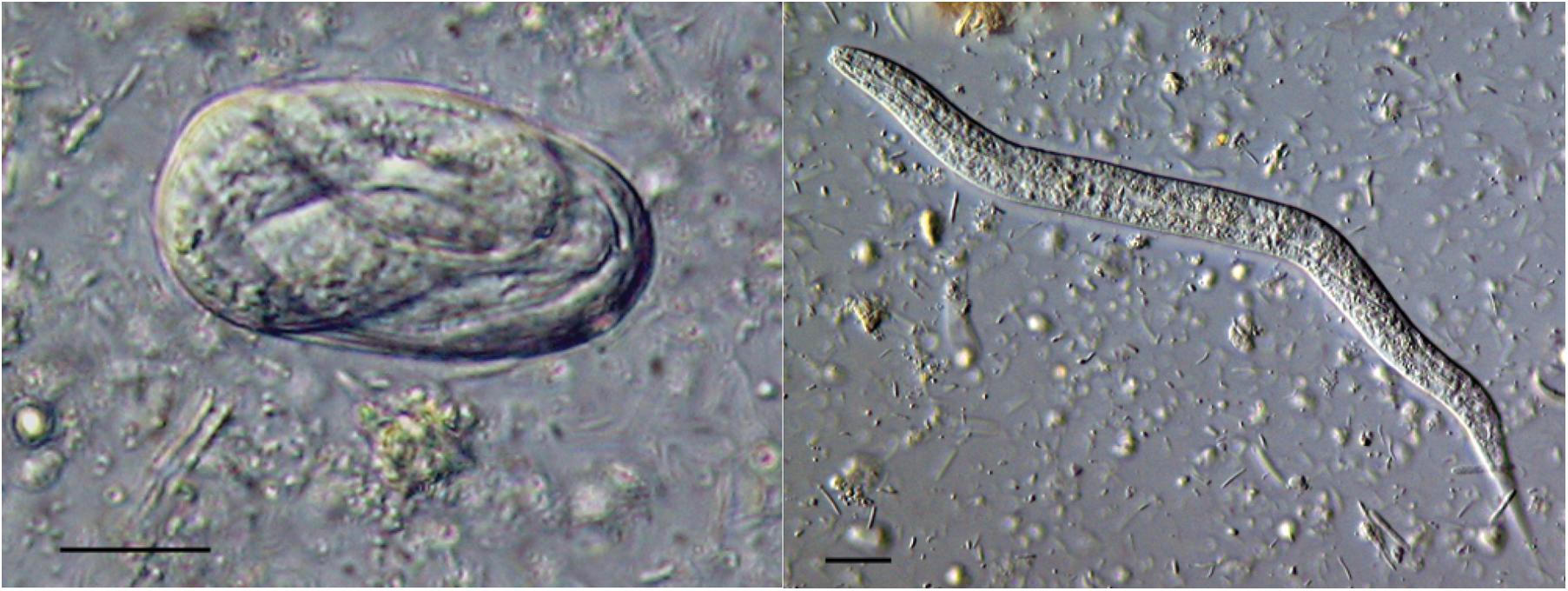 Strongyloides stercoralis