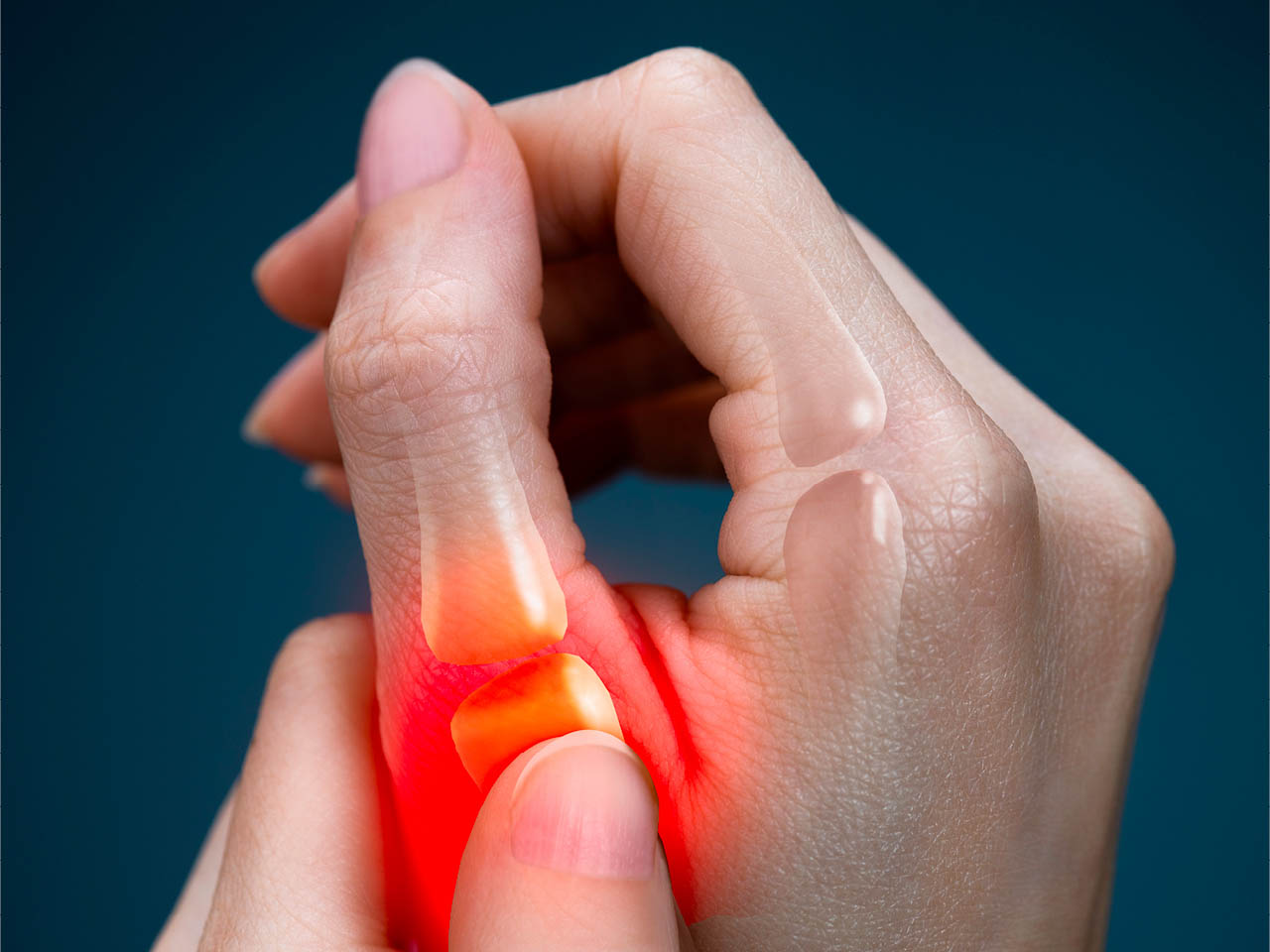 Thumb Arthritis