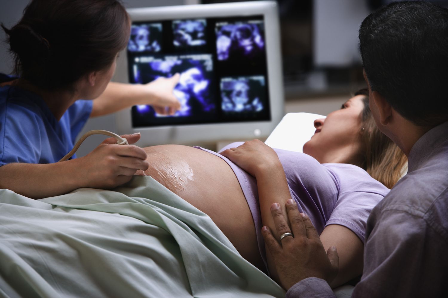 Ultrasound During Pregnancy