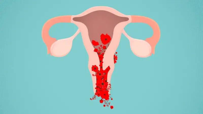 Vaginal Bleeding