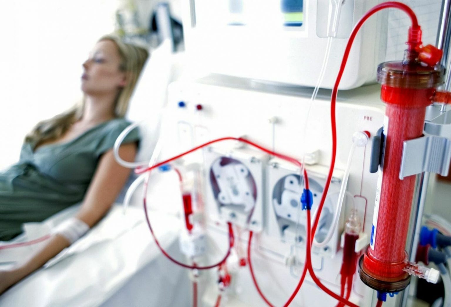 dialysis